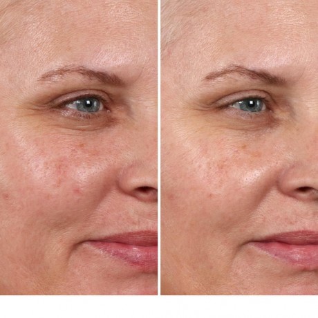 IT Cosmetics Hello Results Baby-Smooth Glycolic Peel + Caring Oil Fruchtsaure Peeling  Hello Results Baby-Smooth Glycolic Peel + Caring Oil пилинг с фруктовыми кислотами