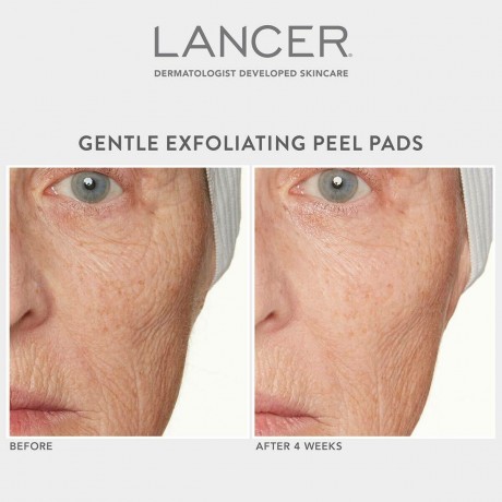 Lancer Gentle Exfoliating Peel Pads  Нежные отшелушивающие подушечки для пилинга