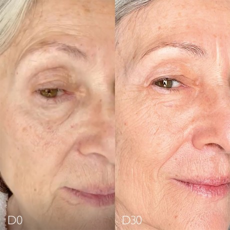 Caudalie Anti-Pigmentflecken Creme Крем против пигментации