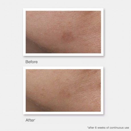 MURAD Rapid Age Spot Correcting Serum  Сыворотка для коррекции пигментных пятен Rapid