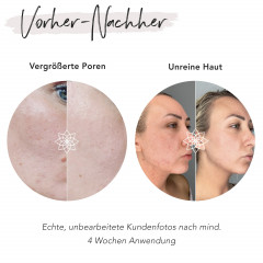 FACES OF FEY Microneedlingset Basic Niacinamid 0,50mm  Набор для микронидлинга Basic Niacinamide 0,50 мм
