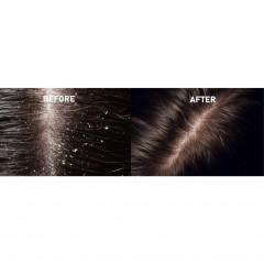 Rosinii Scalp Expert Salicylic Acid + Niacinamide Oily Scalp &amp; Dandruff Treatment  Scalp Expert Салициловая кислота + ниацинамид для жирной кожи головы и против перхоти