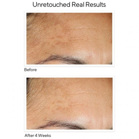 MURAD Vita-C Brightening Serum  Осветляющая сыворотка Vita-C