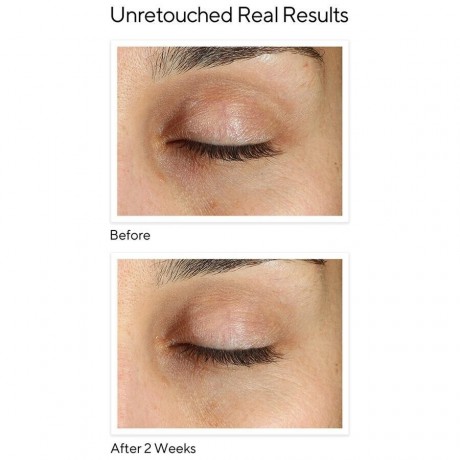 MURAD Vita-C Eyes Dark Circle  Темные круги вокруг глаз Vita-C