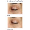 MURAD Vita-C Eyes Dark Circle  Темные круги вокруг глаз Vita-C
